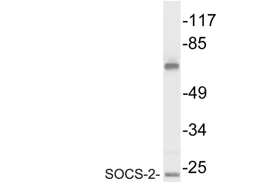 Western Blot - Anti-SOCS-2 Antibody (R12-2361) - Antibodies.com