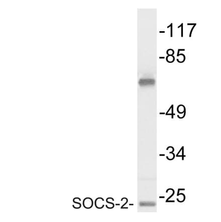 Western Blot - Anti-SOCS-2 Antibody (R12-2361) - Antibodies.com