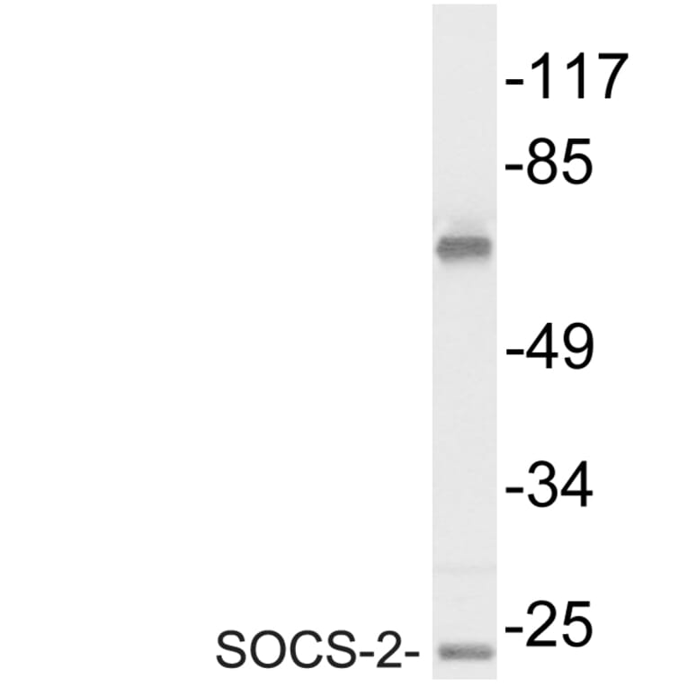 Western Blot - Anti-SOCS-2 Antibody (R12-2361) - Antibodies.com