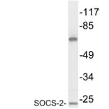 Western Blot - Anti-SOCS-2 Antibody (R12-2361) - Antibodies.com