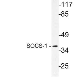 Western Blot - Anti-SOCS-1 Antibody (R12-2360) - Antibodies.com