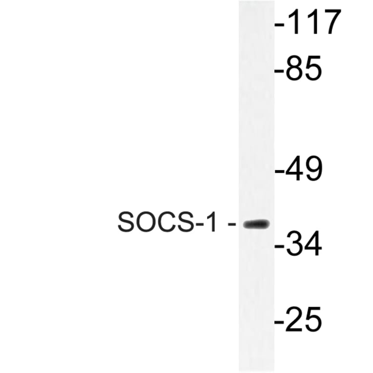 Western Blot - Anti-SOCS-1 Antibody (R12-2360) - Antibodies.com