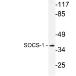 Western Blot - Anti-SOCS-1 Antibody (R12-2360) - Antibodies.com