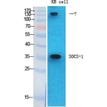 Western Blot - Anti-SOCS-1 Antibody (R12-2360) - Antibodies.com