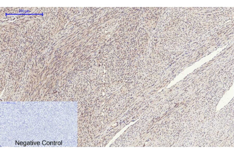 Immunohistochemistry - Anti-SOCS-1 Antibody (R12-2360) - Antibodies.com