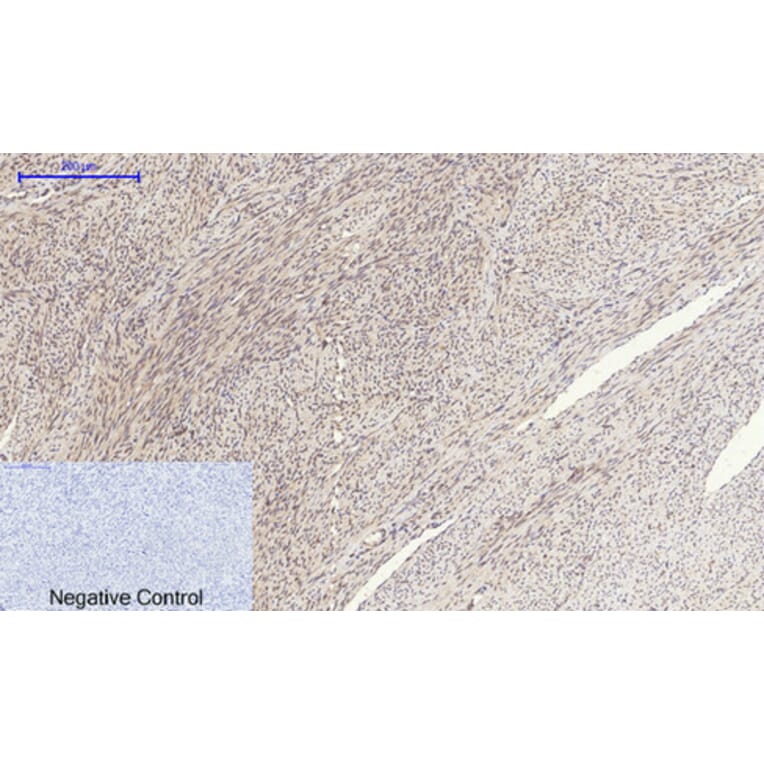 Immunohistochemistry - Anti-SOCS-1 Antibody (R12-2360) - Antibodies.com