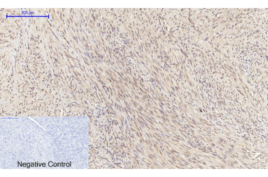 Immunohistochemistry - Anti-SOCS-1 Antibody (R12-2360) - Antibodies.com