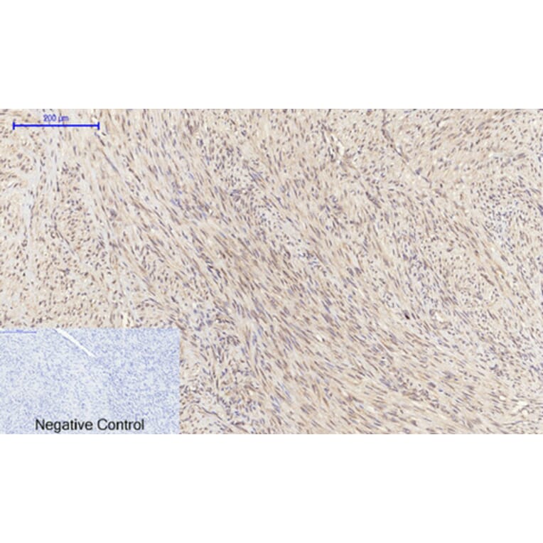 Immunohistochemistry - Anti-SOCS-1 Antibody (R12-2360) - Antibodies.com