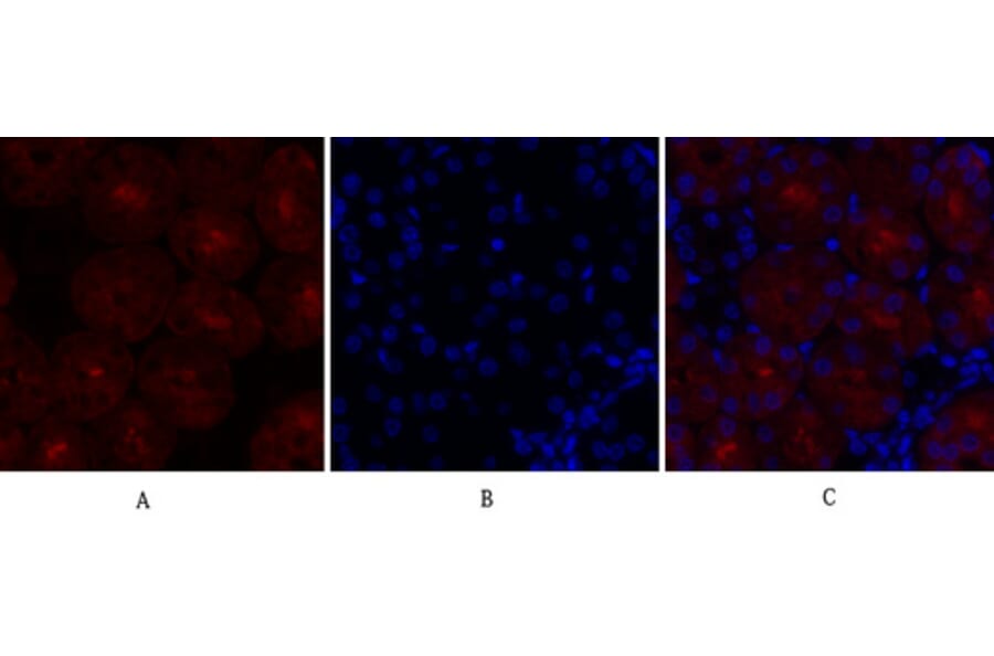 Immunofluorescence - Anti-SOCS-1 Antibody (R12-2360) - Antibodies.com
