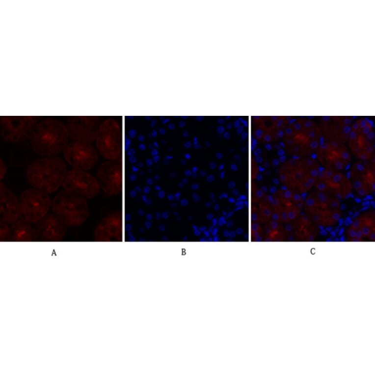 Immunofluorescence - Anti-SOCS-1 Antibody (R12-2360) - Antibodies.com