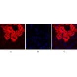 Immunofluorescence - Anti-SOCS-1 Antibody (R12-2360) - Antibodies.com