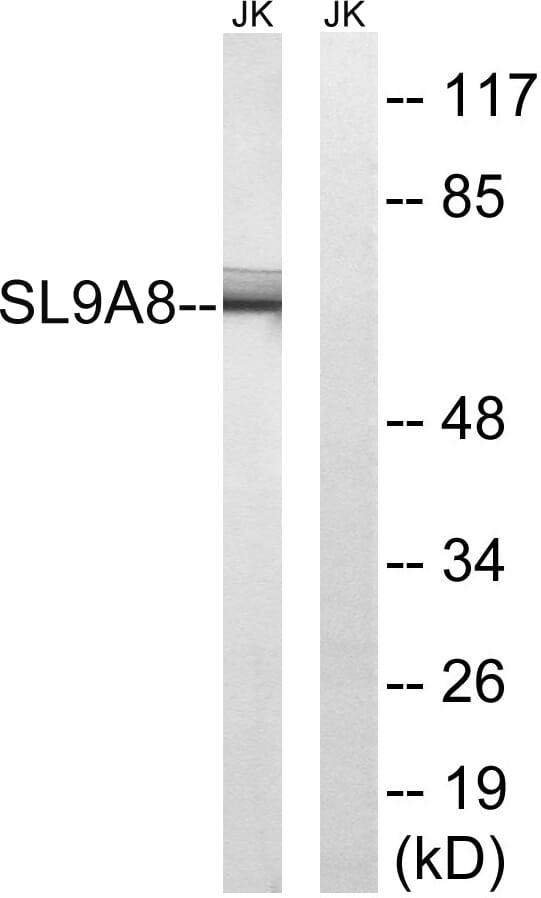 Western blot analysis of lysates from Jurkat cells using Anti-SLC9A8 Antibody. The right hand lane represents a negative control, where the antibody is blocked by the immunising peptide.