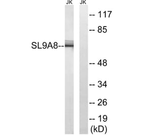 Western Blot - Anti-SLC9A8 Antibody (C18840) - Antibodies.com