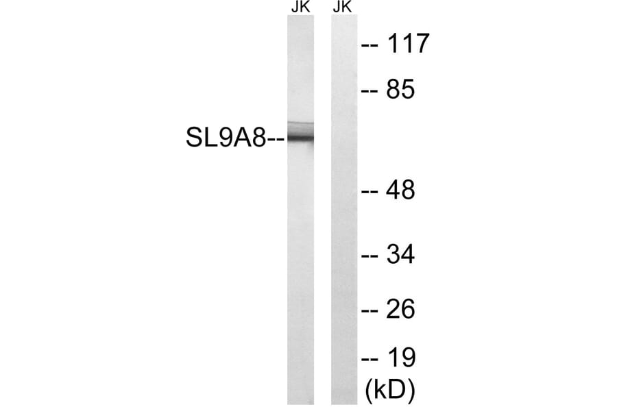 Western Blot - Anti-SLC9A8 Antibody (C18840) - Antibodies.com