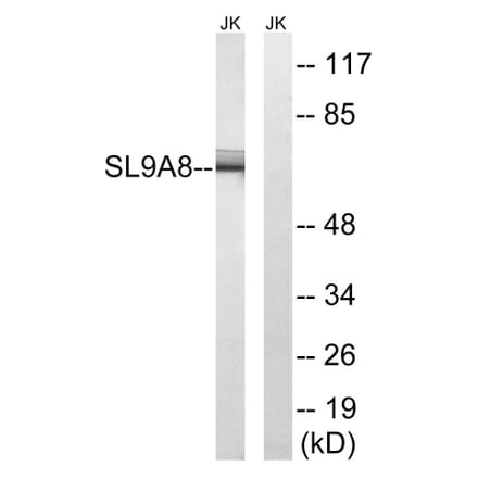 Western Blot - Anti-SLC9A8 Antibody (C18840) - Antibodies.com