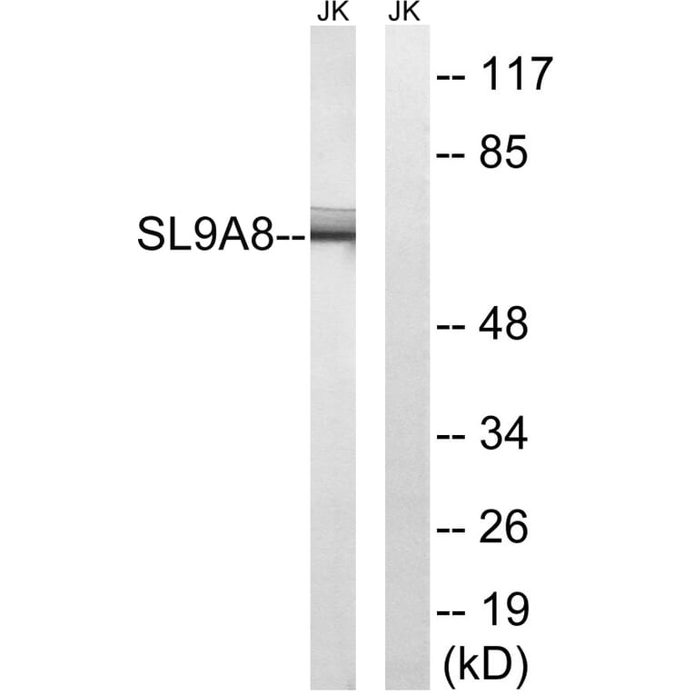 Western Blot - Anti-SLC9A8 Antibody (C18840) - Antibodies.com