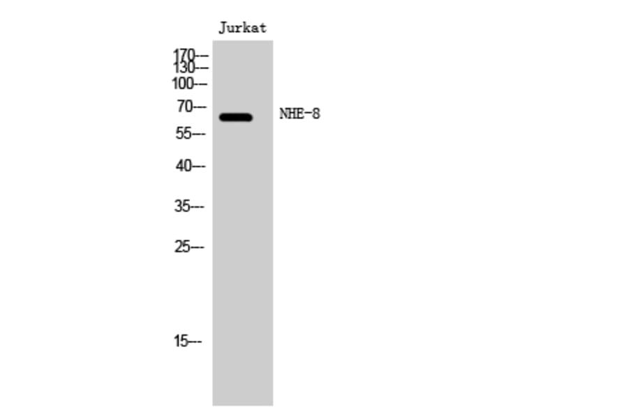 Western Blot - Anti-SLC9A8 Antibody (C18840) - Antibodies.com