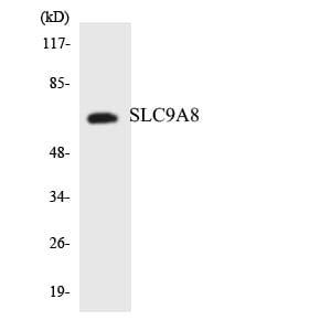 Western blot analysis of the lysates from HeLa cells using Anti-SLC9A8 Antibody.