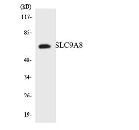 Western Blot - Anti-SLC9A8 Antibody (R12-3540) - Antibodies.com
