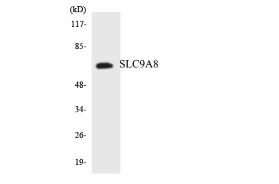 Western Blot - Anti-SLC9A8 Antibody (R12-3540) - Antibodies.com