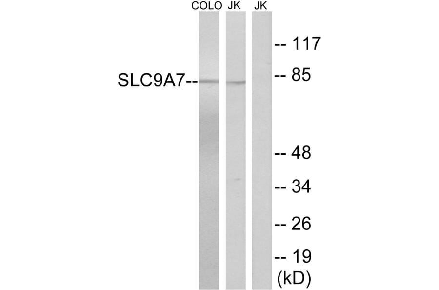Western Blot - Anti-SLC9A7 Antibody (C18839) - Antibodies.com