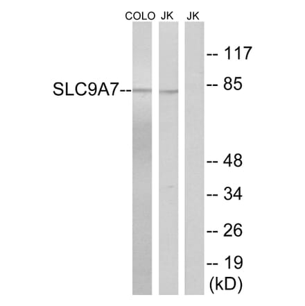 Western Blot - Anti-SLC9A7 Antibody (C18839) - Antibodies.com
