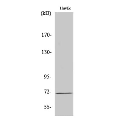 Western Blot - Anti-SLC6A8 Antibody (C18796) - Antibodies.com