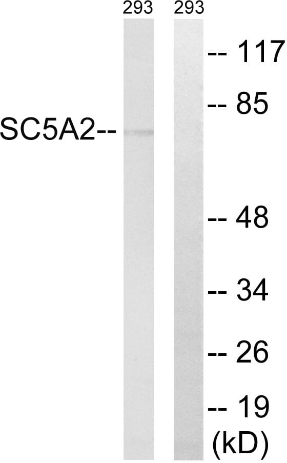 Western blot analysis of lysates from 293 cells using Anti-SLC5A2 Antibody. The right hand lane represents a negative control, where the antibody is blocked by the immunising peptide.