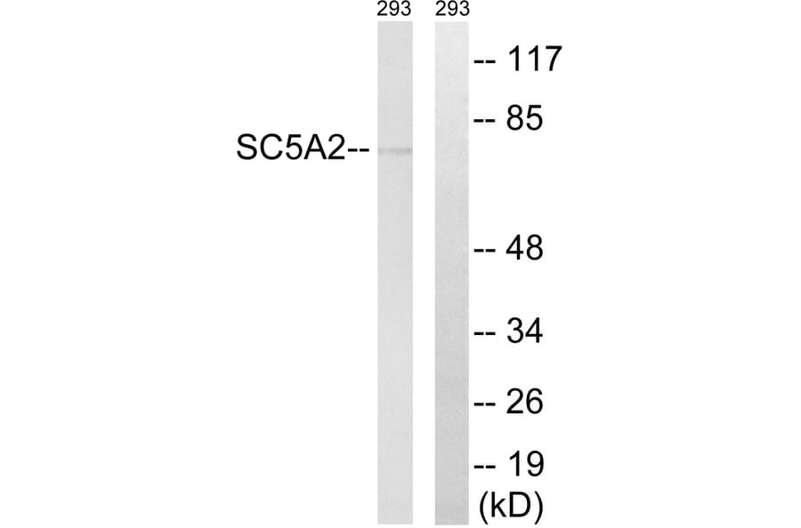 Western Blot - Anti-SLC5A2 Antibody (C18831) - Antibodies.com