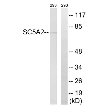 Western Blot - Anti-SLC5A2 Antibody (C18831) - Antibodies.com