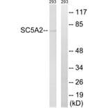 Western Blot - Anti-SLC5A2 Antibody (C18831) - Antibodies.com