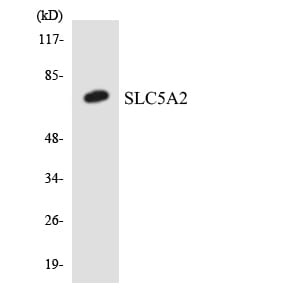 Western blot analysis of the lysates from Jurkat cells using Anti-SLC5A2 Antibody.