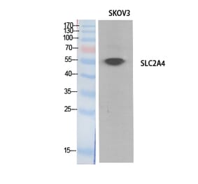 Western Blot - Anti-SLC2A4 Antibody (C30273) - Antibodies.com