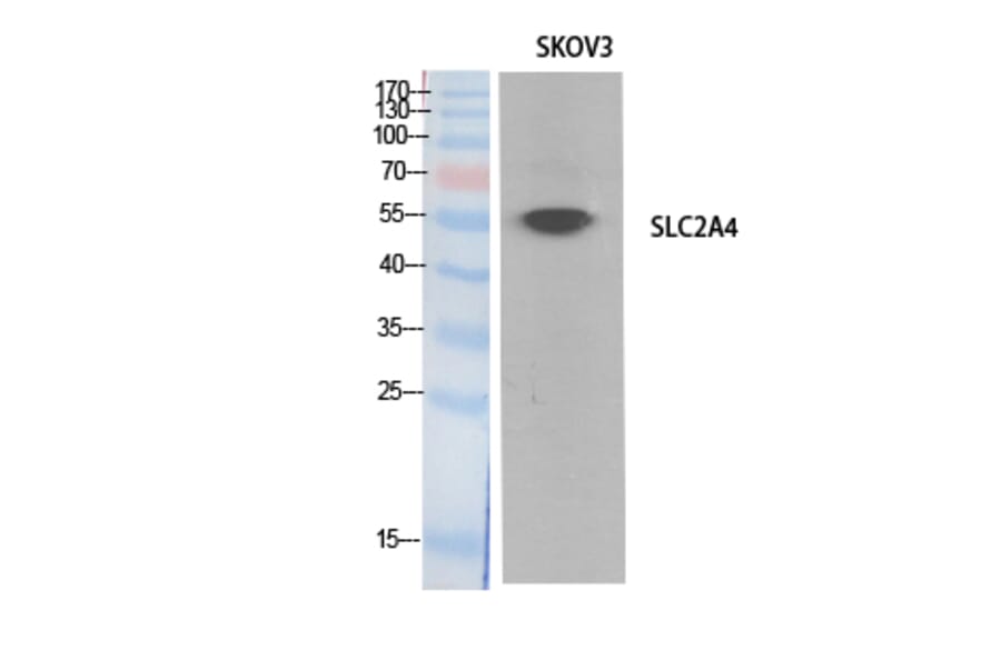 Western Blot - Anti-SLC2A4 Antibody (C30273) - Antibodies.com