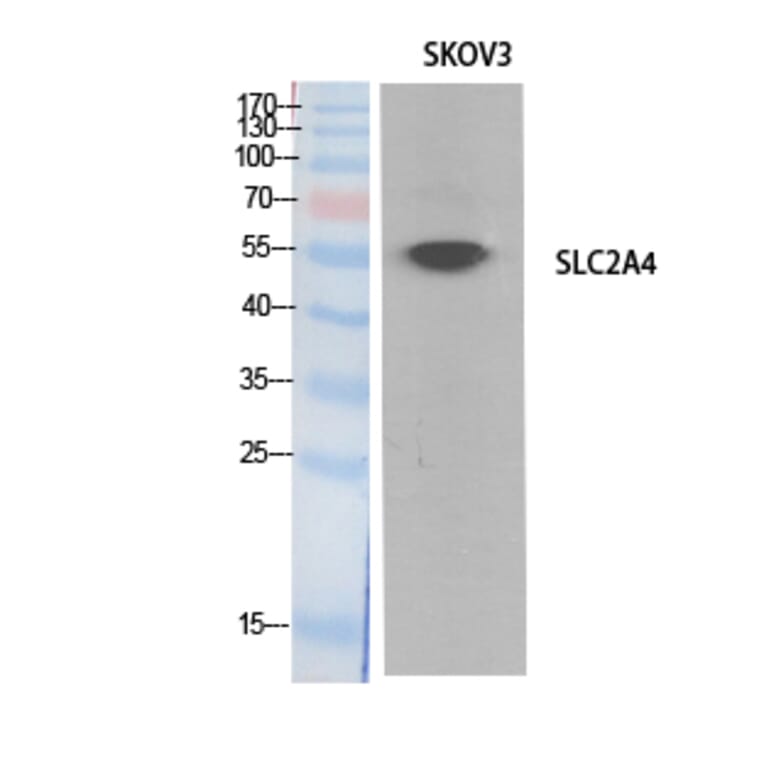 Western Blot - Anti-SLC2A4 Antibody (C30273) - Antibodies.com