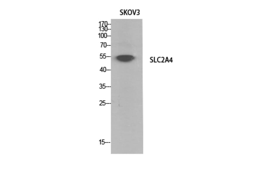 Western Blot - Anti-SLC2A4 Antibody (C30273) - Antibodies.com