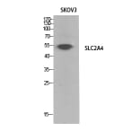 Western Blot - Anti-SLC2A4 Antibody (C30273) - Antibodies.com