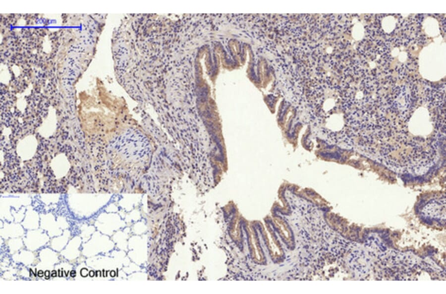 Immunohistochemistry - Anti-SLC2A4 Antibody (C30273) - Antibodies.com