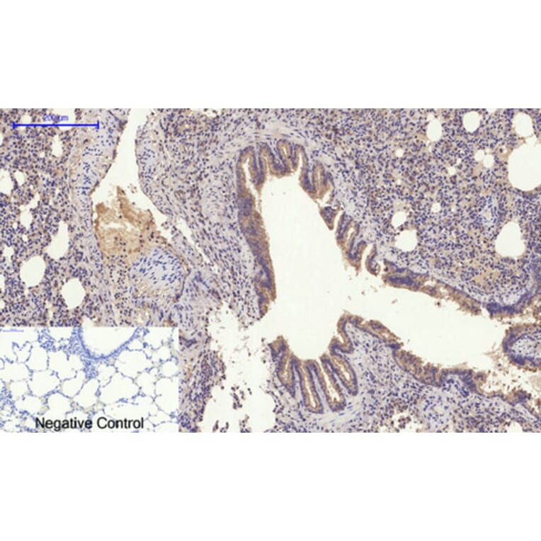 Immunohistochemistry - Anti-SLC2A4 Antibody (C30273) - Antibodies.com