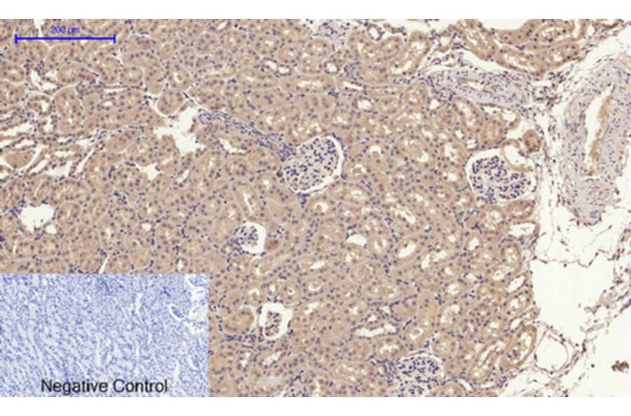 Immunohistochemistry - Anti-SLC2A4 Antibody (C30273) - Antibodies.com