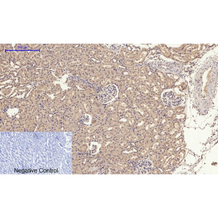Immunohistochemistry - Anti-SLC2A4 Antibody (C30273) - Antibodies.com
