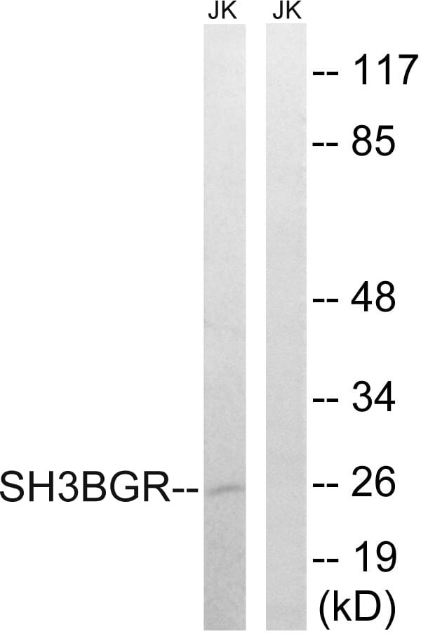 Western blot analysis of lysates from Jurkat cells using Anti-SH3BGR Antibody. The right hand lane represents a negative control, where the antibody is blocked by the immunising peptide.