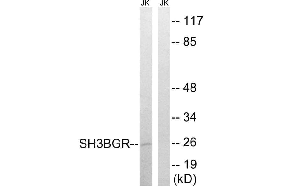 Western Blot - Anti-SH3BGR Antibody (C18718) - Antibodies.com