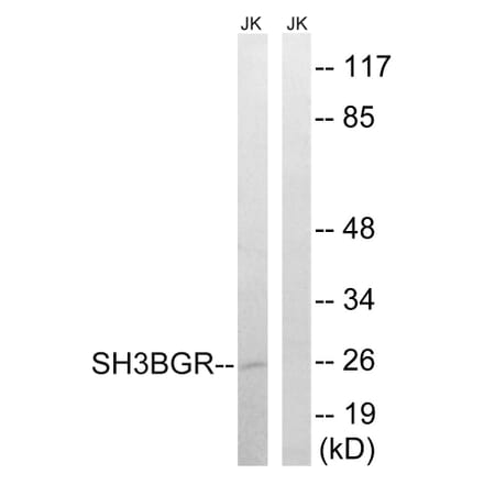 Western Blot - Anti-SH3BGR Antibody (C18718) - Antibodies.com
