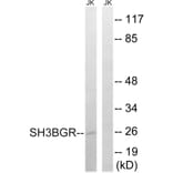 Western Blot - Anti-SH3BGR Antibody (C18718) - Antibodies.com