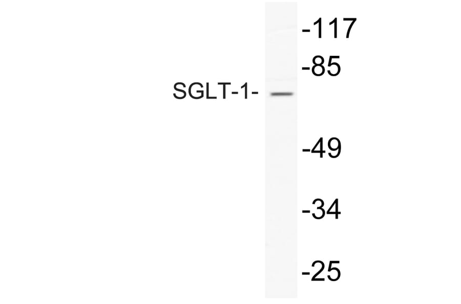Western Blot - Anti-SGLT-1 Antibody (R12-2355) - Antibodies.com