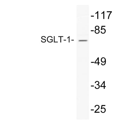 Western Blot - Anti-SGLT-1 Antibody (R12-2355) - Antibodies.com