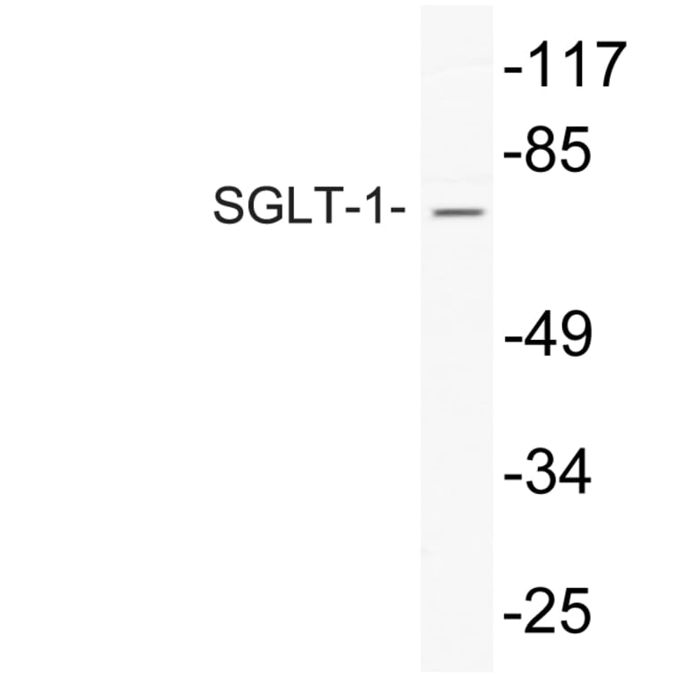 Western Blot - Anti-SGLT-1 Antibody (R12-2355) - Antibodies.com