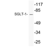Western Blot - Anti-SGLT-1 Antibody (R12-2355) - Antibodies.com