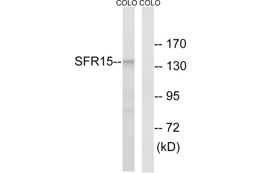 Western Blot - Anti-SFRS15 Antibody (C18932) - Antibodies.com